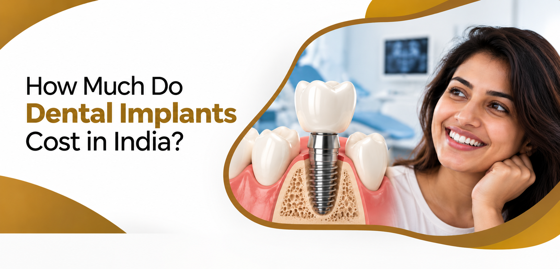 How much does dental implant cost in India