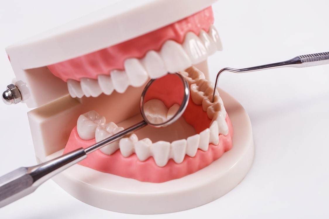 Never Ignor Your Teeth