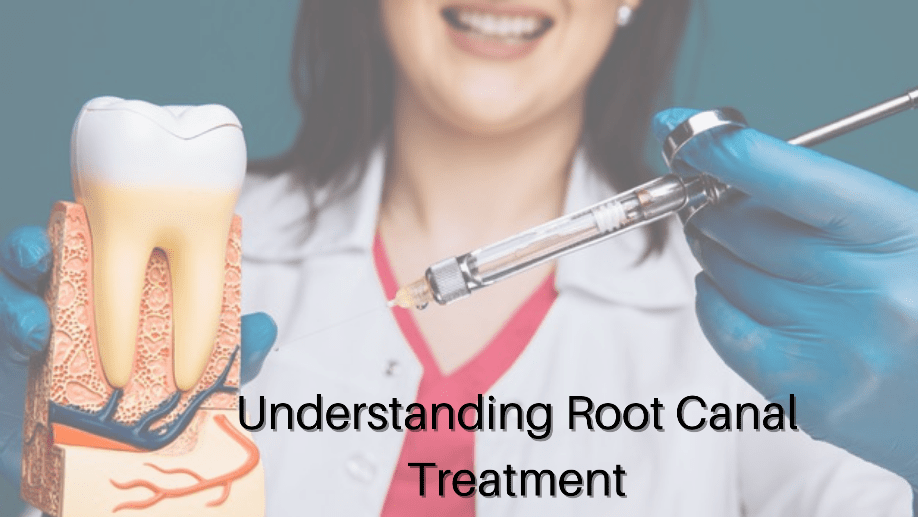 Understanding Root Canal Treatment