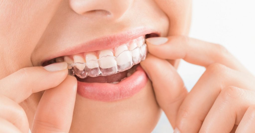 Laser Treatment Gums