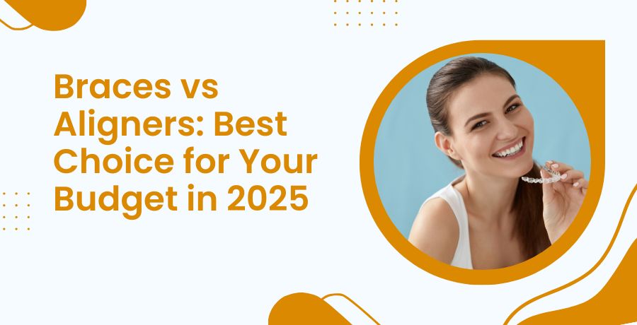 Aligners vs Braces