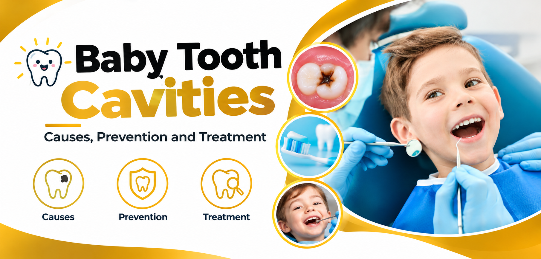 baby tooth cavities