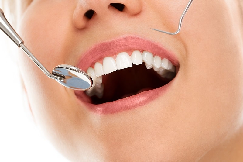 Oral Health