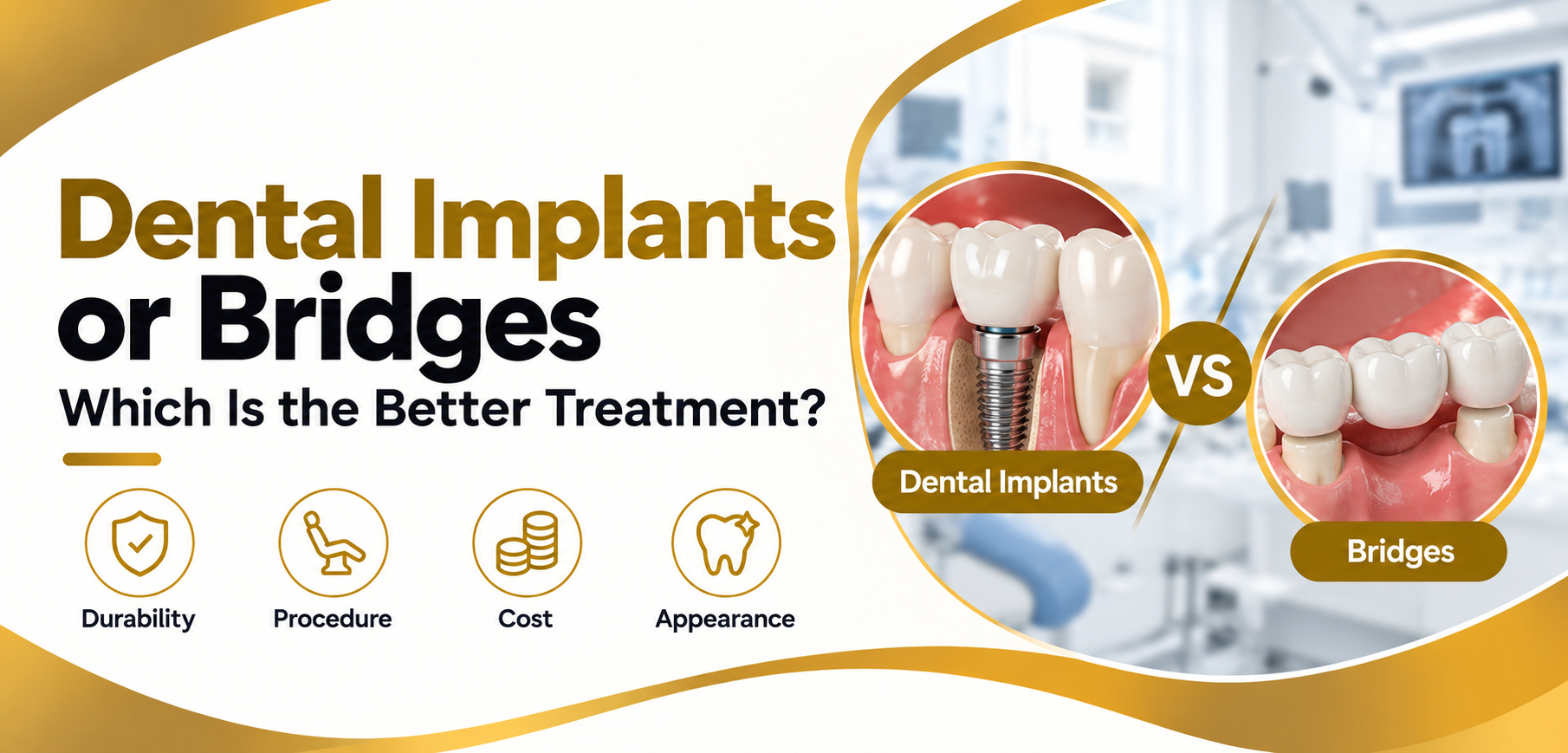 dental implants or bridges