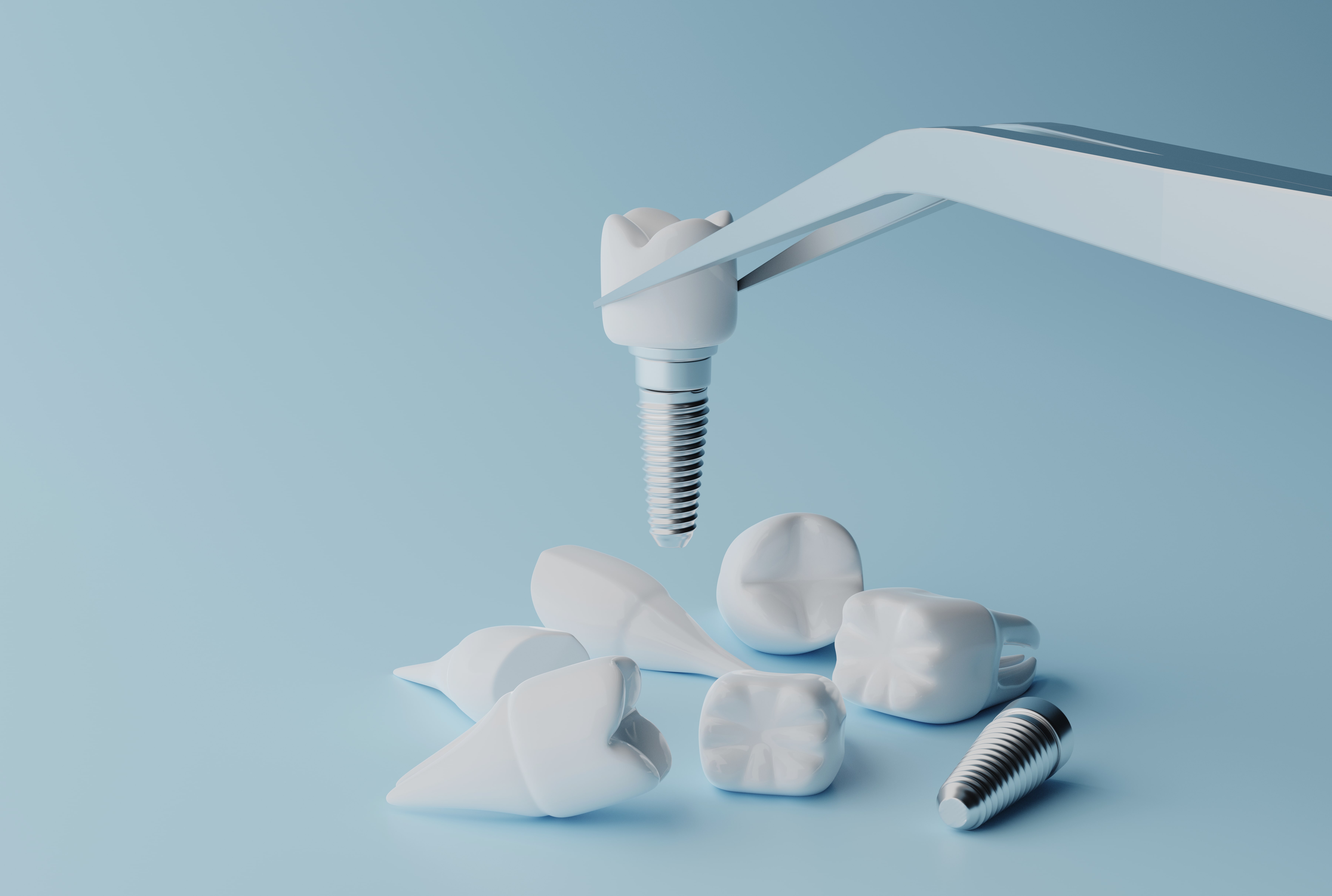 Dental Implants