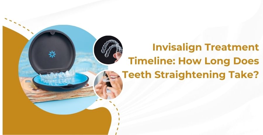 How Long Does Teeth Whitening Takes