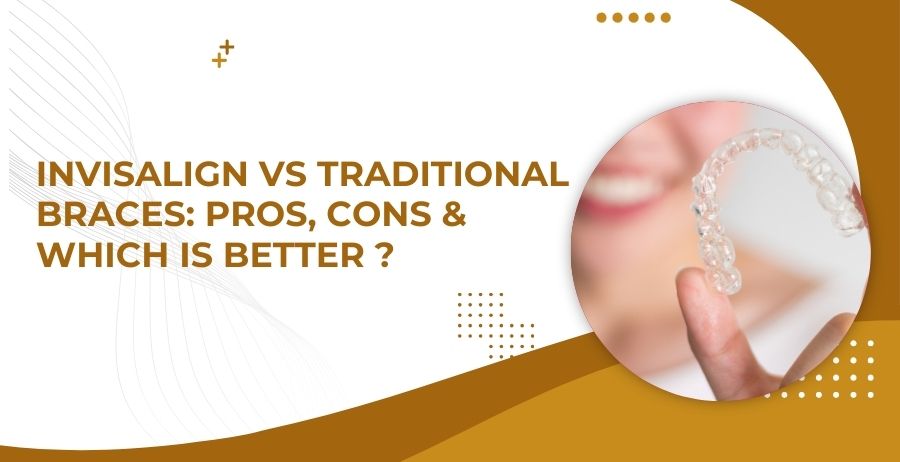 Invisalign vs Braces