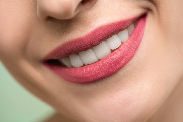 GET A SMILE MAKEOVER TODAY