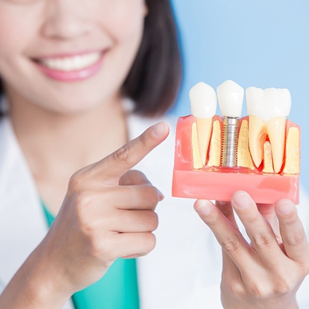 Dental Implants in Gurgaon