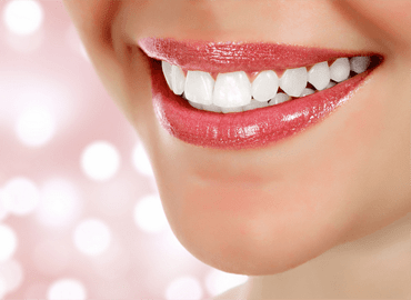 Teeth Filling